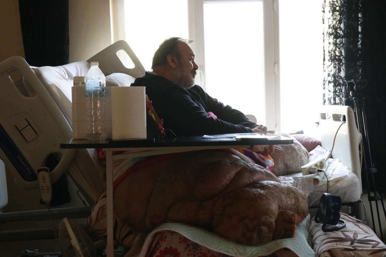 300 kiloluk hayata sıkıştı, 5 yıldır dört duvar arasında 8